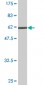 GLUL monoclonal antibody (M01A), clone 2B12